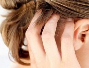 signos e síntomas de psoríase no coiro cabeludo